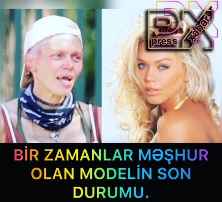 MƏŞHUR MODELİN SON HALI